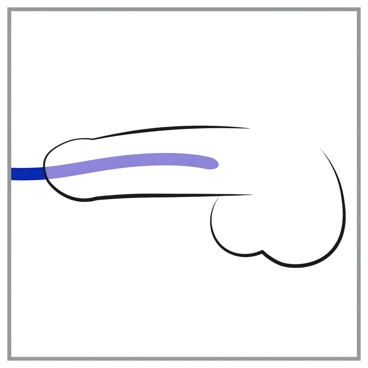 You2Toys - DILATOR - szilikon dilátor szett (3 db) You2Toys - DILATOR - szilikon dilátor szett (3 db)